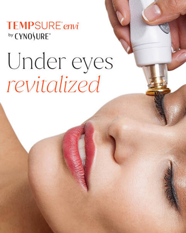 temspure-eyes Aria's Tempsure treatment helps remove under eye wrinkles
