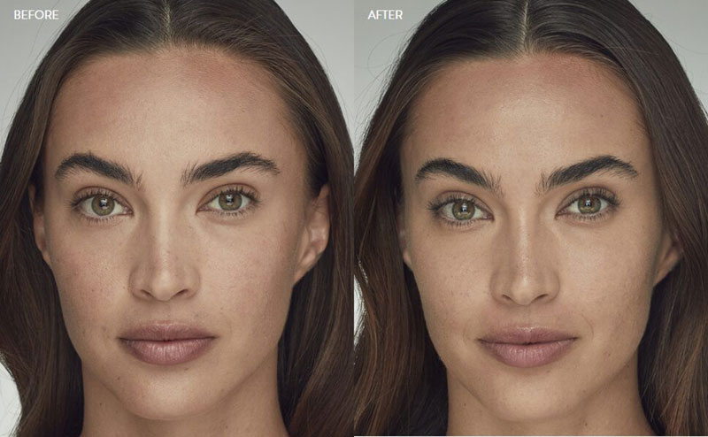 Latisse-Before-and-After Aria Latisse before and after image